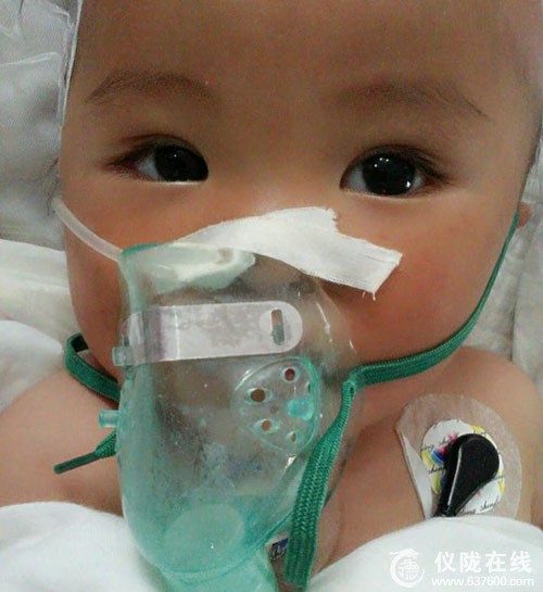 仪陇11月女婴被精神病患母亲烫伤双下肢 已转院治疗